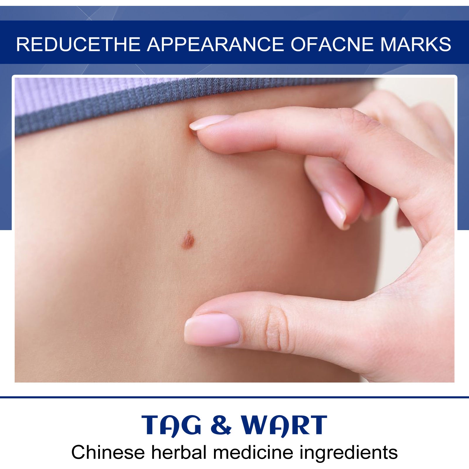 Skin Care Cream Body Skin Care Cleansing, Smoothing And Rejuvenating Topical Care Cream - PULSE MART