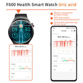 New 1.55-inch Disc Smart Watch Health Tracker Health Manager - PULSE MART