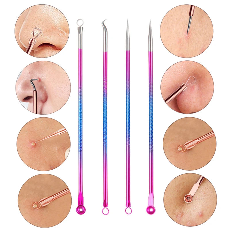 4PCS Acne Blackhead Comedone Black Spot Pimple Blemish Remover Skin Care - PULSE MART