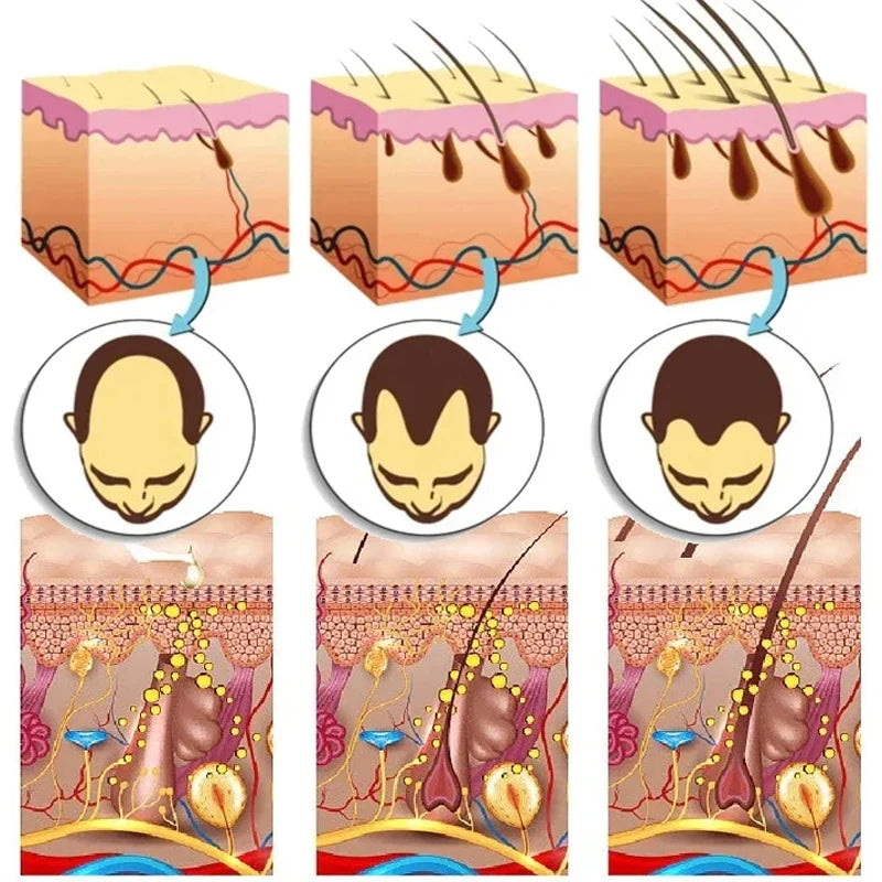 7-Day Ginger Hair Growth Serum - Fast Hair Regrowth, Anti-Hair Loss, and Scalp Nourishing Treatment - PULSE MART