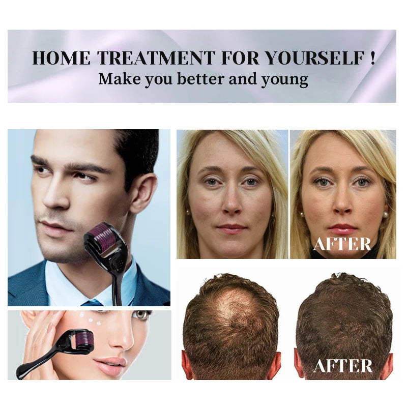 540 Needles Derma Roller - Microneedling Tool for Skin Care, Beard Growth, and Hair Regrowth (0.2mm, 0.25mm, 0.3mm) - PULSE MART