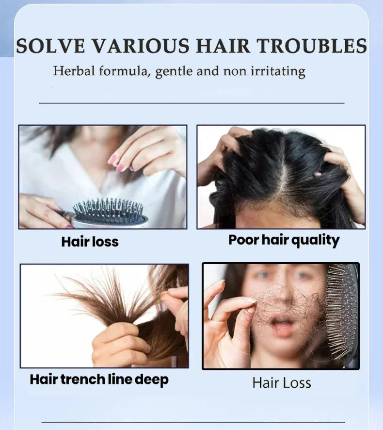 Hair Growth Serum - Anti-Hair Loss Solution for Seborrheic Alopecia and Hereditary Hair Loss with Nourishing Essential Oils - PULSE MART