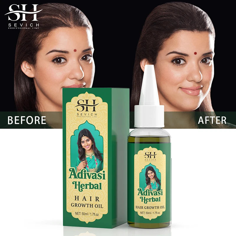 Adivasi Ayurvedic Hair Growth Oil - Organic Serum for Fast Regrowth, Thicker Hair, and Hair Loss Prevention - PULSE MART