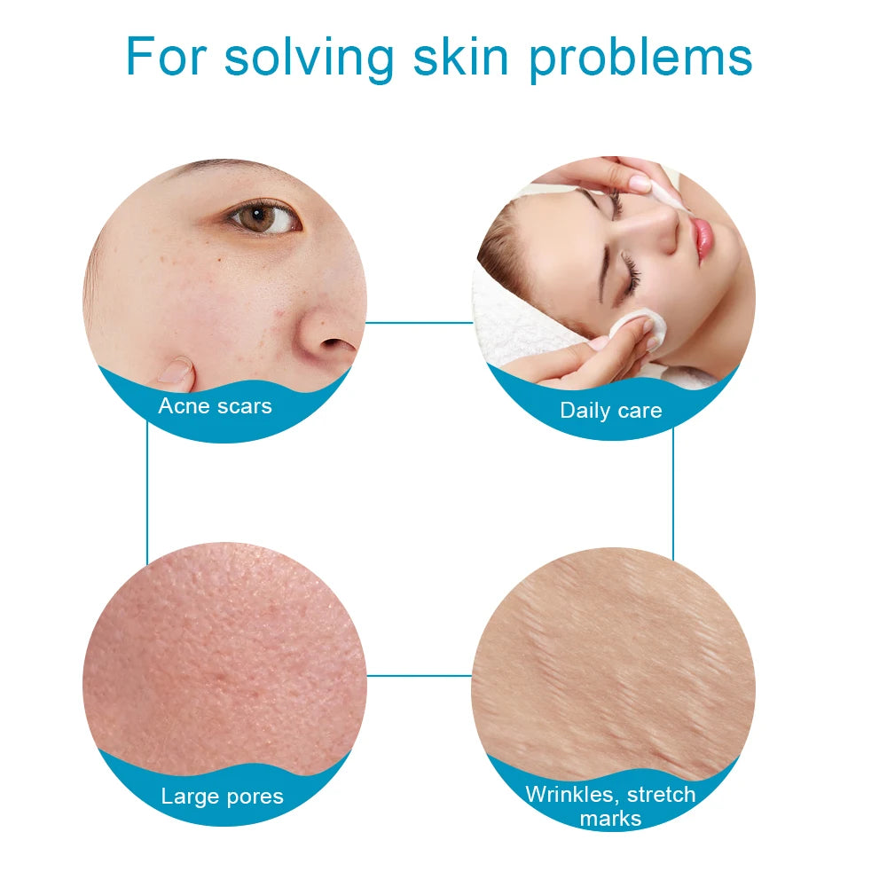 540 Needles Microneedle Derma Roller - Facial and Body Hair Growth Enhancer, Skin Care and Microneedling Tool - PULSE MART