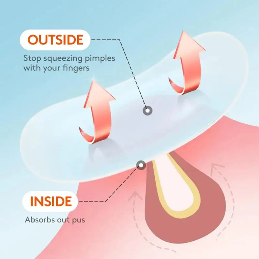 30PCS Hydrocolloid Salicylic Acid Acne Pimple Patch - PULSE MART