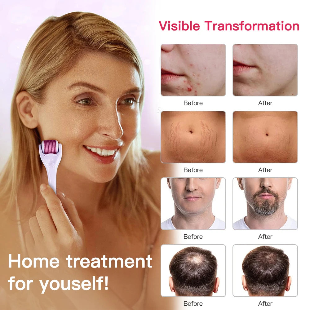 540 Titanium Derma Roller - Hair and Beard Regrowth Tool for Skin Care and Anti-Aging - PULSE MART