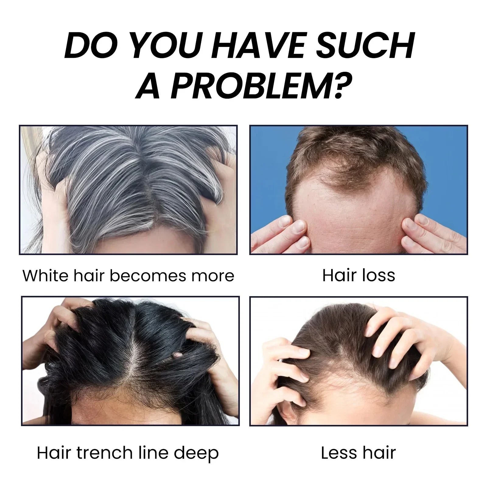 Fast Hair Growth Serum - Treatment for Hair Thinning, Anti-Hair Loss, Prevent Baldness, Scalp Cure, and Strong Roots - PULSE MART