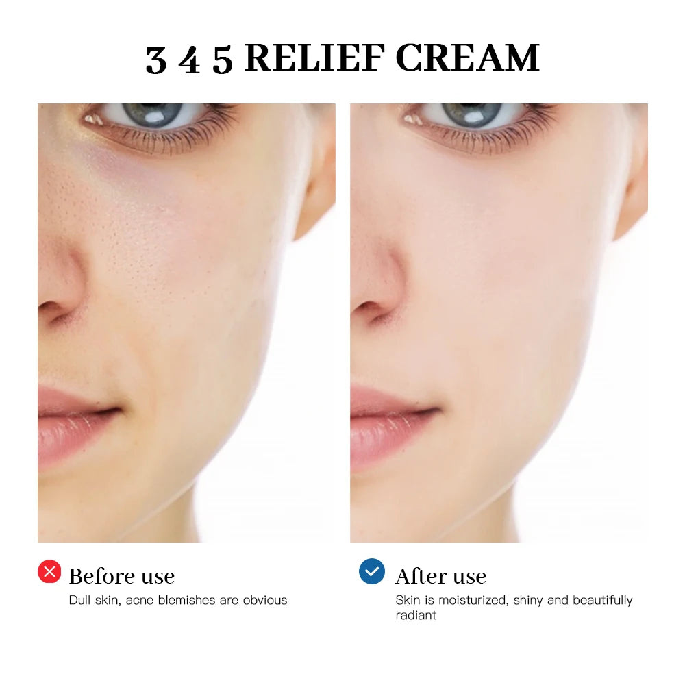 345 Relief Cream Comprehensive Skin Solution • Anti-Sugar • Antioxidant • Brightening &amp; Moisturizing - PULSE MART