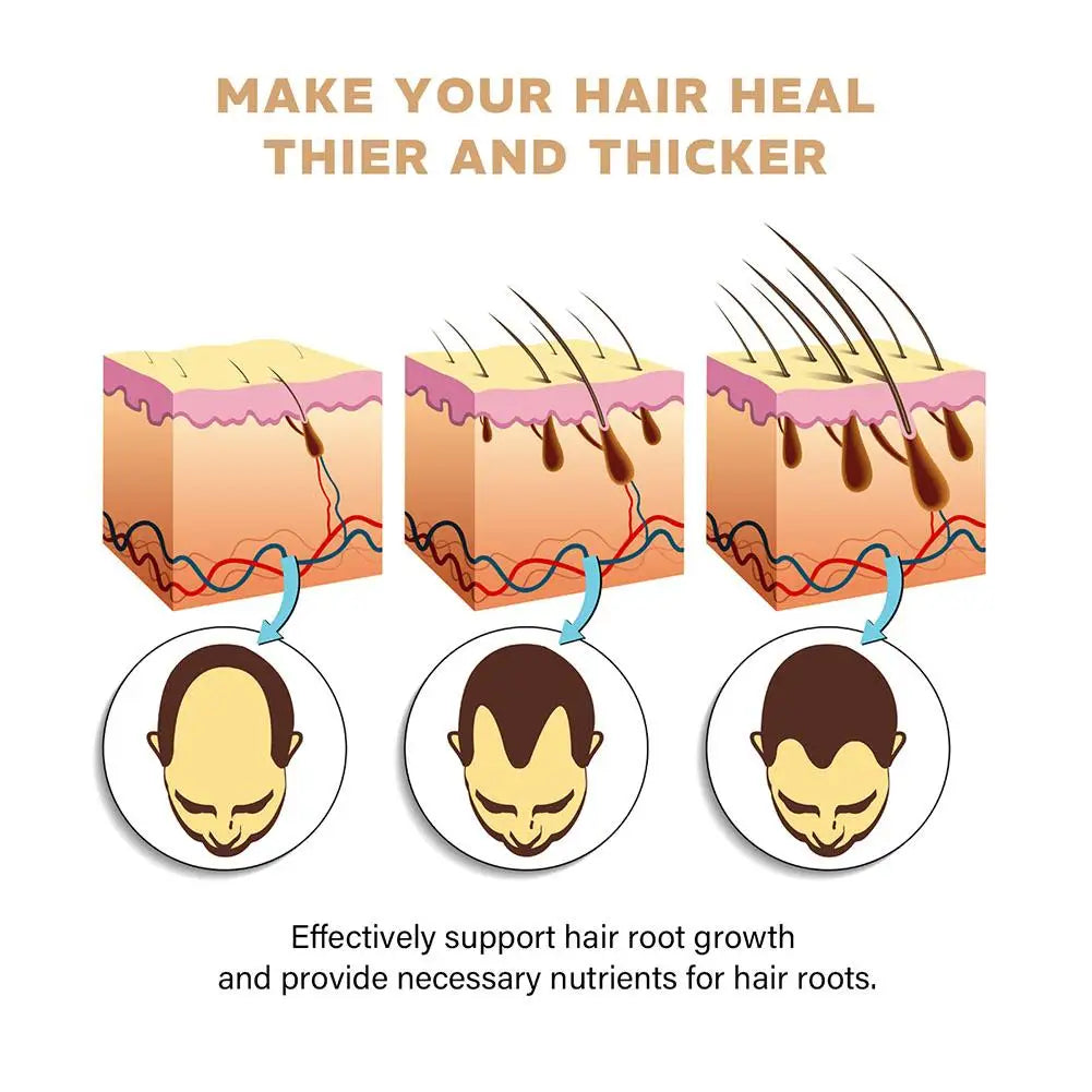 Hair Loss Treatment Shampoo - Promotes Hair Growth, Strengthens Roots, Repairs Scalp, and Thickening Care - PULSE MART