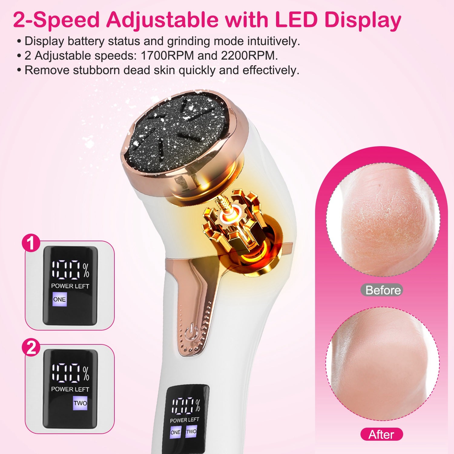 17Pcs Electric Foot Callus Remover With Vacuum Foot Grinder Rechargeable Foot File Dead Skin Pedicure Machine With 3 Grinding Heads 2 Speeds Foot Care Tool - PULSE MART